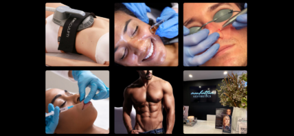 Grid of facial procedure images