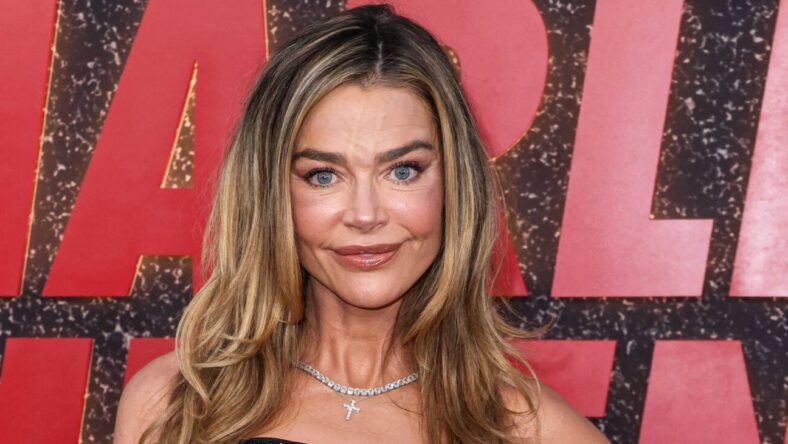 How Denise Richards’ Private Facelift Became A Divorce Flashpoint Before She Spoke Out