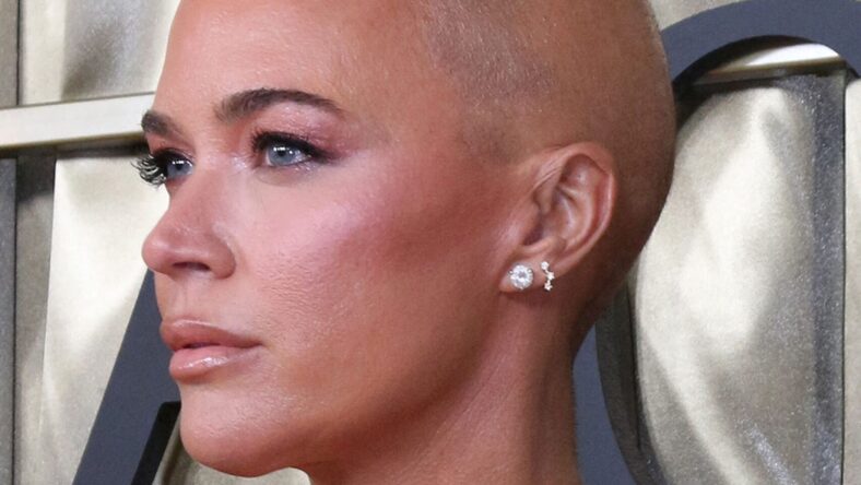 Teddi Mellencamp Defends Plastic Surgery Move Amid Stage 4 Cancer Battle