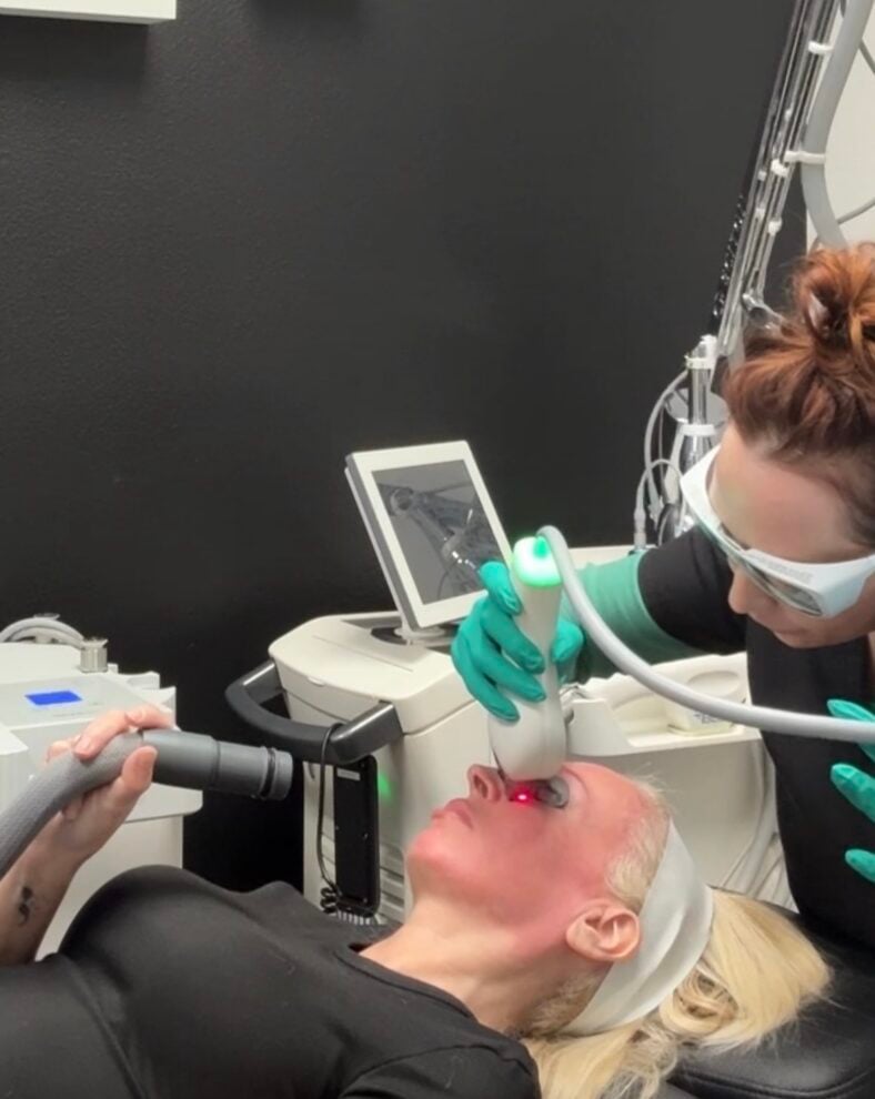 MOXI/BBL Laser Treatment