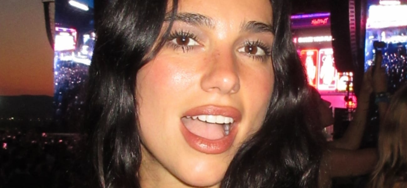 Dua Lipa Sunbathing In Skimpy Striped Bikini Highlights ’10/10′ Body