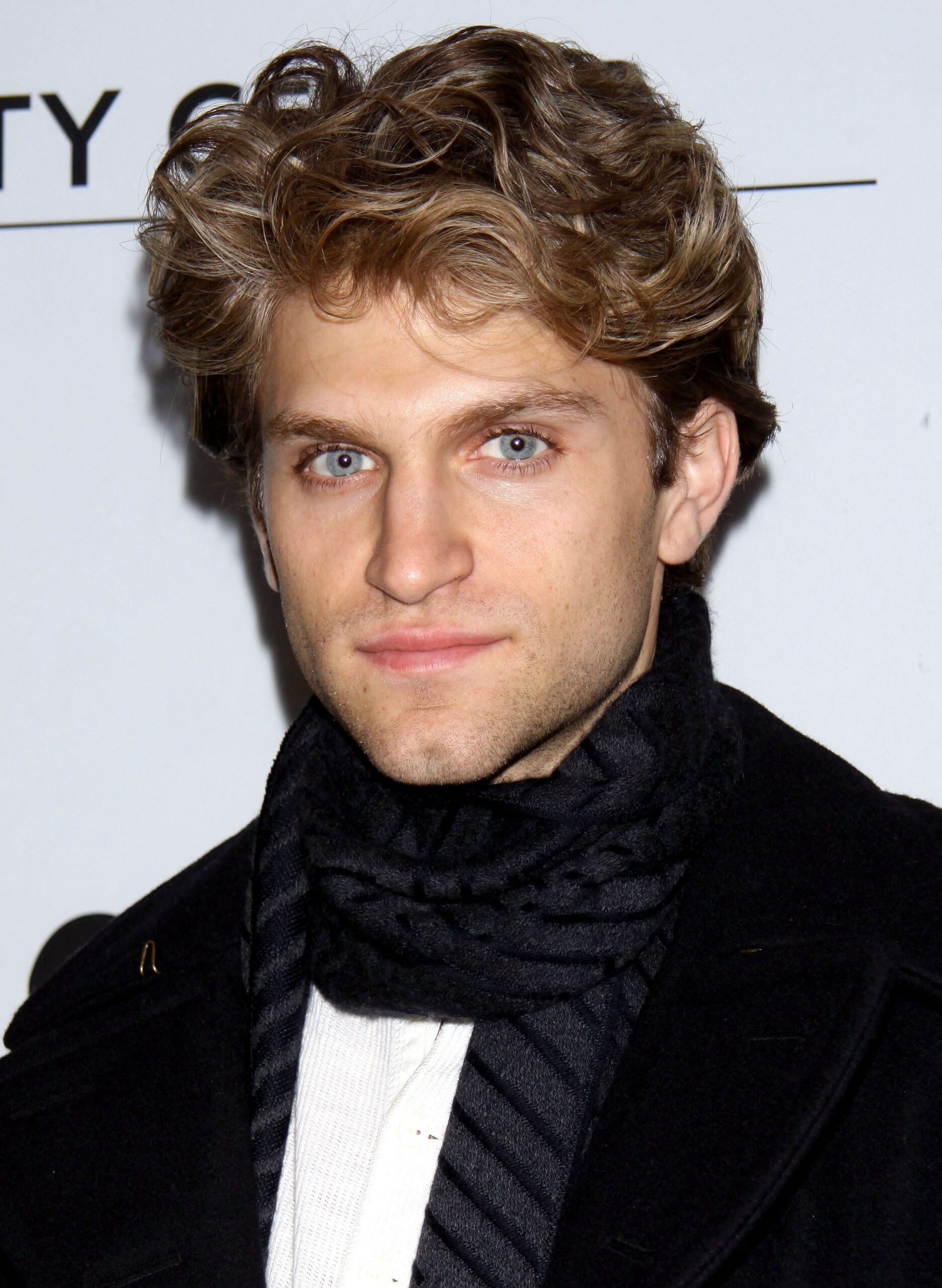 Keegan Allen Reveals Gruesome Robbery Aftermath With Photo Of Stitched Head